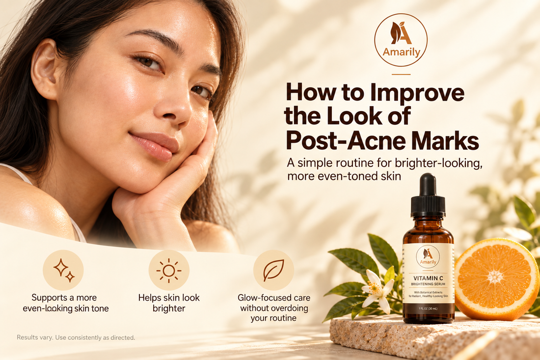 How to Fade Post Acne Marks Without Overdoing It